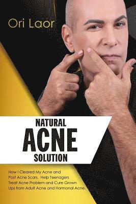 bokomslag Natural Acne Solution: How I Cleared My Acne and Post Acne Scars. Help Teenagers Treat Acne Problem and Cure Grown Ups from Adult Acne and Hormonal Ac