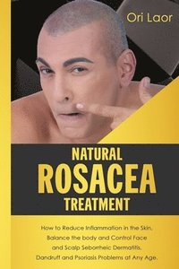 bokomslag Natural Rosacea Treatment: How to Reduce Inflammation in the Skin, Balance the body and Control Face and Scalp Seborrheic Dermatitis, Dandruff an