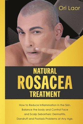 Natural Rosacea Treatment: How to Reduce Inflammation in the Skin, Balance the body and Control Face and Scalp Seborrheic Dermatitis, Dandruff an 1