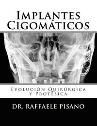 bokomslag Implantes Cigomáticos: Evolución Quirúrgica y Protésica