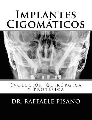 Implantes Cigomáticos: Evolución Quirúrgica y Protésica 1