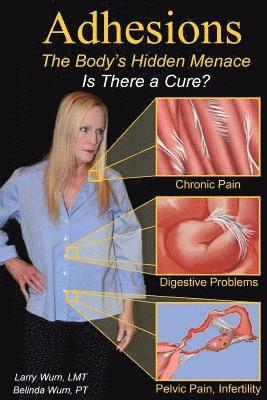 Adhesions: The Body's Inner Menace - Is There a Cure? 1