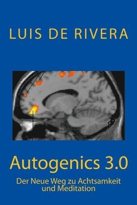 Autogenics 3.0 1