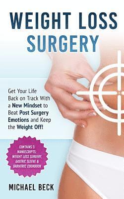 Michael Beck - Weight Loss Surgery: Get Your Life Back on Track With a New Mindset to Beat Post Surgery Emotions and Keep the Weight Off! (Contains 3 Manu, Häftad
