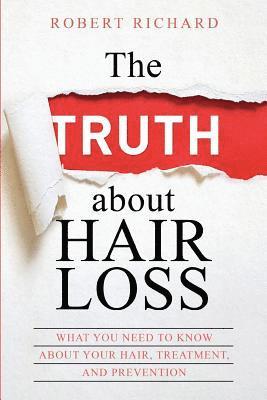 Hairloss Cure, Alopecia Cure, Robert Richard, Hairloss cure, Alopecia cure - TRUTH about Hair Loss, Häftad