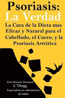 Psoriasis: La Verdad: La cura de la dieta más eficaz y natural para el cuero cabelludo, el cuerpo y la psoriasis artrítica 1