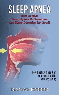 bokomslag Sleep Apnea