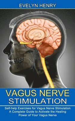 Vagus Nerve Stimulation 1