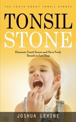 bokomslag Tonsil Stones