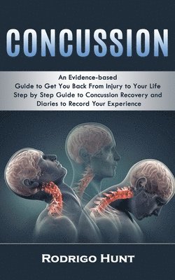 bokomslag Concussion