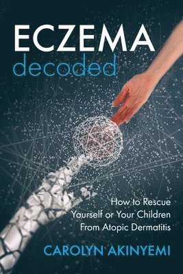 Carolyn Akinyemi - Eczema Decoded, Häftad