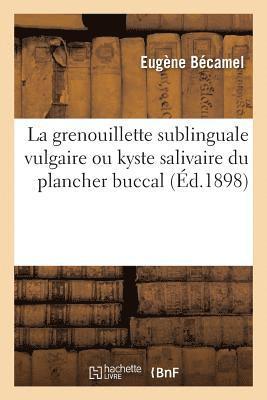 L'Etude de la Grenouillette Sublinguale Vulgaire Ou Kyste Salivaire Du Plancher Buccal 1