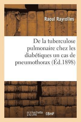 bokomslag de la Tuberculose Pulmonaire Chez Les Diabétiques Un Cas de Pneumothorax