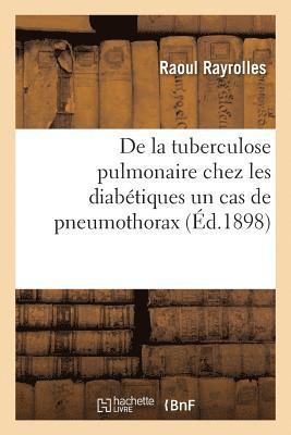 bokomslag de la Tuberculose Pulmonaire Chez Les Diabetiques Un Cas de Pneumothorax