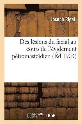 Des Lesions Du Facial Au Cours de l'Evidement Petromastoidien 1