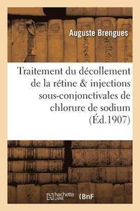 bokomslag Du Traitement Du Decollement de la Retine & Injections Sous-Conjonctivales de Chlorure de Sodium