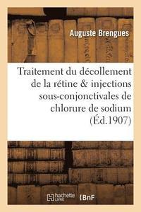 bokomslag Du Traitement Du Décollement de la Rétine & Injections Sous-Conjonctivales de Chlorure de Sodium