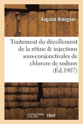 bokomslag Du Traitement Du Décollement de la Rétine & Injections Sous-Conjonctivales de Chlorure de Sodium