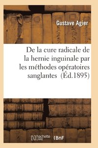 bokomslag de la Cure Radicale de la Hernie Inguinale Par Les Methodes Operatoires Sanglantes