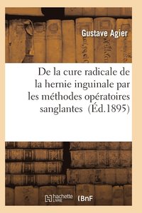bokomslag de la Cure Radicale de la Hernie Inguinale Par Les Méthodes Opératoires Sanglantes