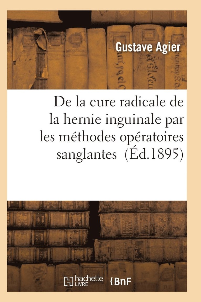 de la Cure Radicale de la Hernie Inguinale Par Les Methodes Operatoires Sanglantes 1