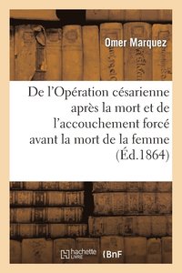 bokomslag de l'Opration Csarienne Aprs La Mort. de l'Accouchement Forc Avant La Mort de la Femme Enceinte
