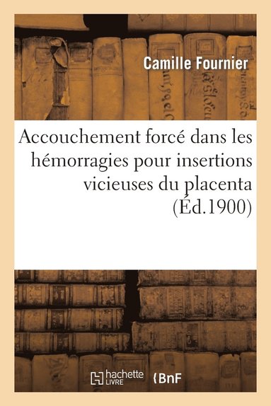 Camille Fournier - Accouchement forcé dans les hémorragies pour insertions vicieuses du placenta, Häftad