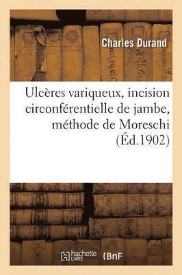 bokomslag Ulcres Variqueux, Incision Circonfrentielle de Jambe, Mthode de Moreschi