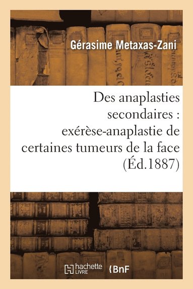 bokomslag Des Anaplasties Secondaires: Cure En Deux Temps Exérèse-Anaplastie de Certaines Tumeurs de la Face