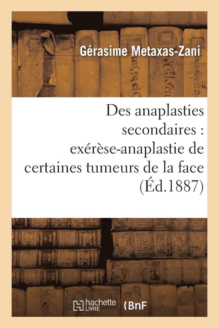 Des Anaplasties Secondaires: Cure En Deux Temps Exerese-Anaplastie de Certaines Tumeurs de la Face 1