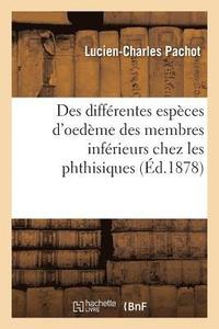 bokomslag Des Différentes Espèces d'Oedème Des Membres Inférieurs Chez Les Phthisiques