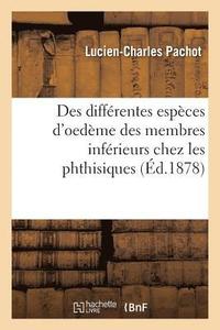 bokomslag Des Diffrentes Espces d'Oedme Des Membres Infrieurs Chez Les Phthisiques