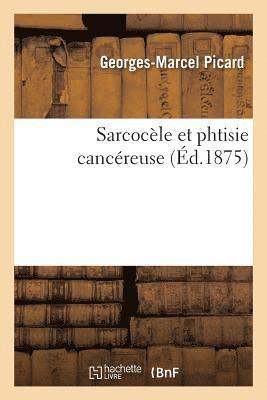 bokomslag Sarcocle Et Phtisie Cancreuse