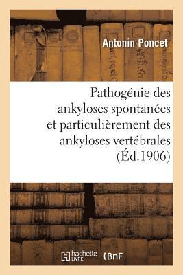 bokomslag Pathognie Des Ankyloses Spontanes Et Particulirement Des Ankyloses Vertbrales