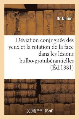 bokomslag Mmoire Sur La Dviation Conjugue Des Yeux Et La Rotation de la Face