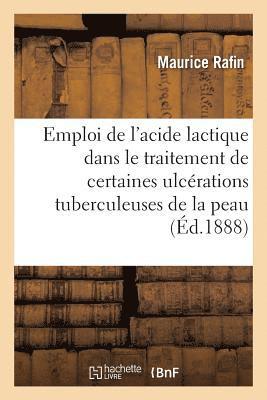 bokomslag de l'Emploi de l'Acide Lactique Dans Le Traitement de Certaines Ulcerations Tuberculeuses