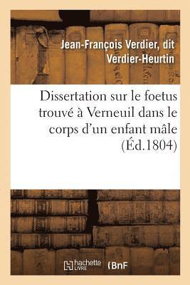 Dissertation Sur Le Foetus Trouve A Verneuil Dans Le Corps d'Un Enfant Male 1