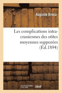 bokomslag Les Complications Intra-Craniennes Des Otites Moyennes Suppures