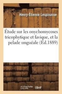 bokomslag tude Sur Les Onychomycoses Tricophytique Et Favique, Et La Pelade Unguale