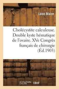 bokomslag Cholecystite Calculeuse. Double Kyste Hematique de l'Ovaire. Xve Congres Francais de Chirurgie