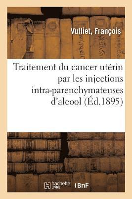 Traitement Du Cancer Utrin Par Les Injections Intra-Parenchymateuses d'Alcool 1
