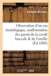 bokomslag Observation d'Un Cas Tratologique Rare: Malformation Des Parois de la Cavit Buccale