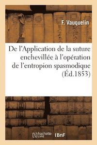 bokomslag de l'Application de la Suture Encheville  l'Opration de l'Entropion Spasmodique