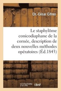 bokomslag Memoire Sur Le Staphylome Conicodiaphane de la Cornee