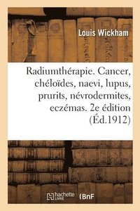 bokomslag Radiumtherapie. Cancer, Cheloides, Naevi, Lupus, Prurits, Nevrodermites, Eczemas
