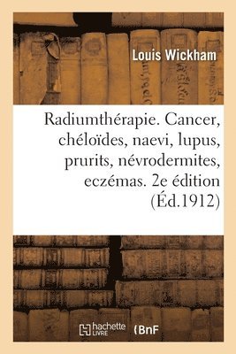 Radiumtherapie. Cancer, Cheloides, Naevi, Lupus, Prurits, Nevrodermites, Eczemas 1