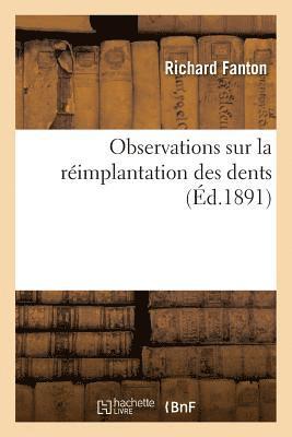 Observations Sur La Rimplantation Des Dents 1