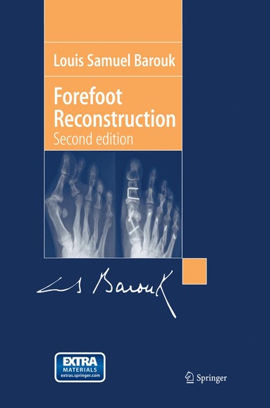 bokomslag Forefoot Reconstruction