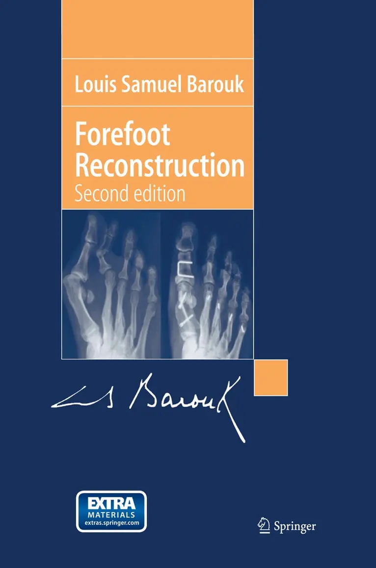 Louis-Samuel Barouk - Forefoot Reconstruction, Häftad. Tillgänglighet: Lägg i varukorg