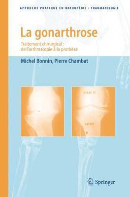 Michel Bonnin, Pierre Chambat - Gonarthrose, Häftad